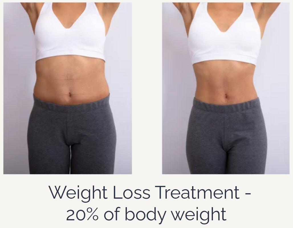 weight loss before after weight loss before after